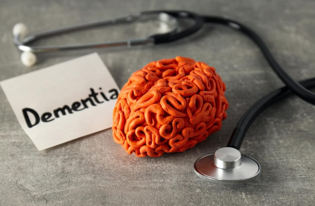 A model brain with a "Dementia" card and stethoscope on a grey surface